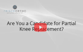Are You a Candidate for Partial Knee Replacement?